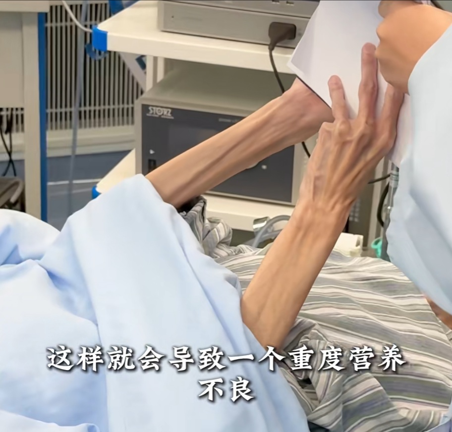 39岁80斤女子疯狂减肥到50斤！每天猛吞200粒“小粉丸”，送医时已皮包骨