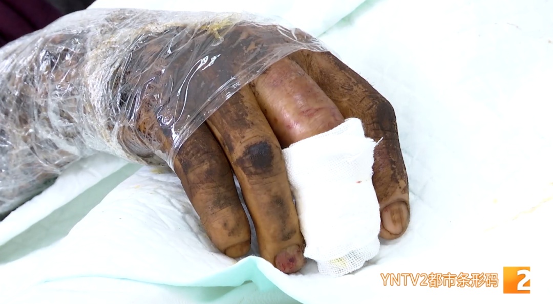 近期高发！昆明有医院已收治上百例患者！医生紧急提醒→