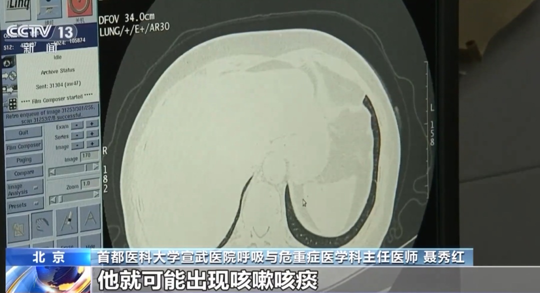 警惕！一个动作就可能导致白肺！很多人都在做...