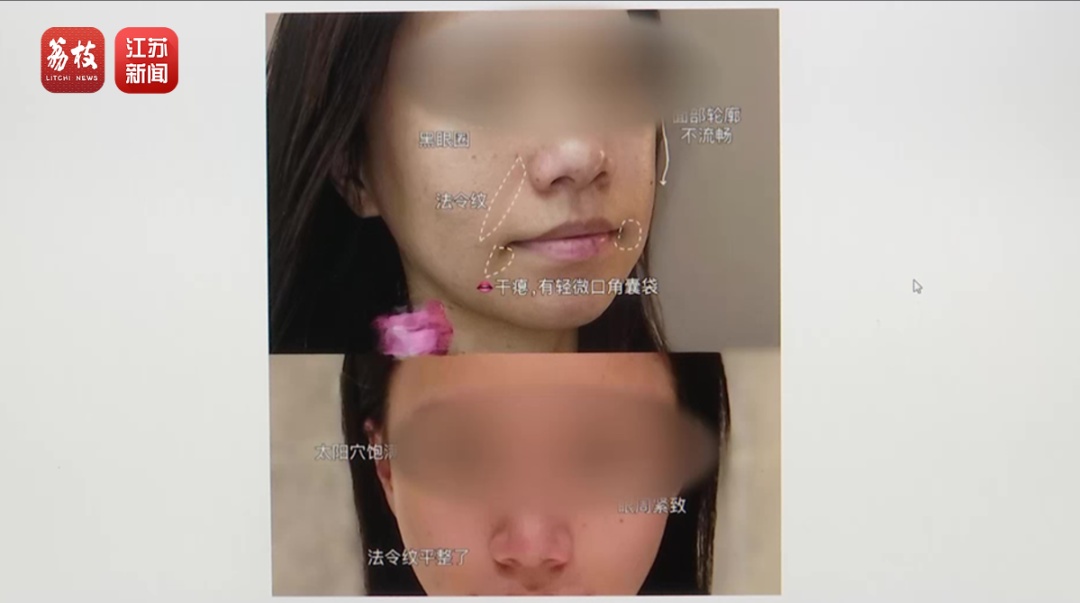 打一针“返老还童”的童颜针卖了30亿，真的有效吗？