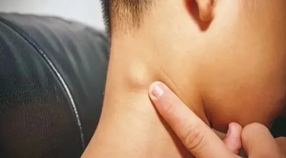 浙江5岁男孩确诊已是晚期，且转移…别忽视身上这种“小疙瘩”，许多人都有
