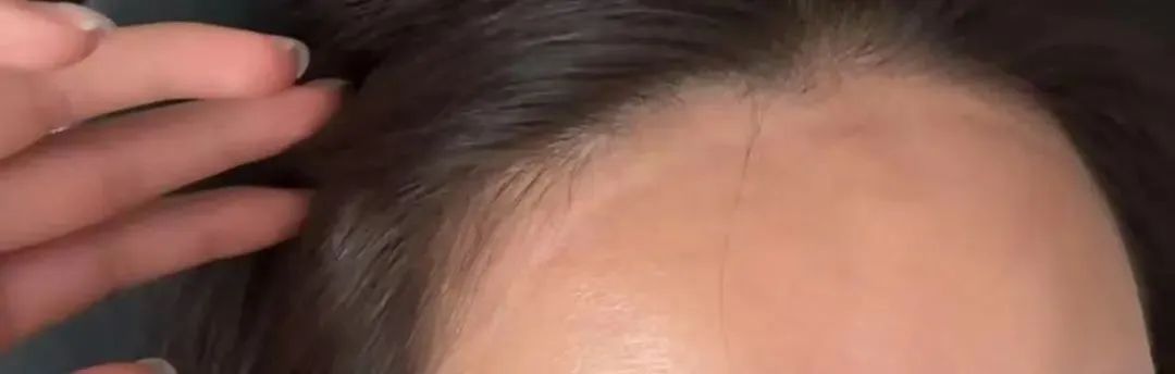 “防晒面罩越戴越黑”！是热黑的还是捂黑的？