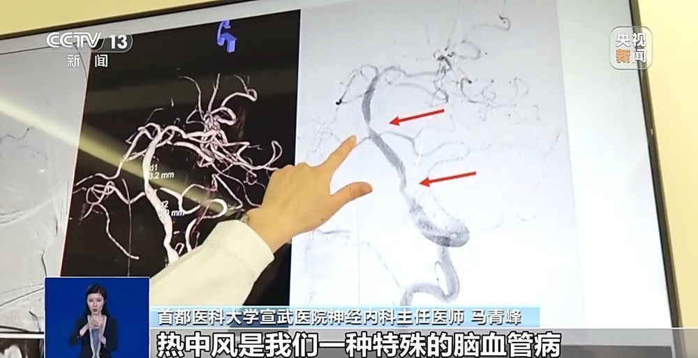 高温天气当心“热中风” 这几类高危人群要警惕！