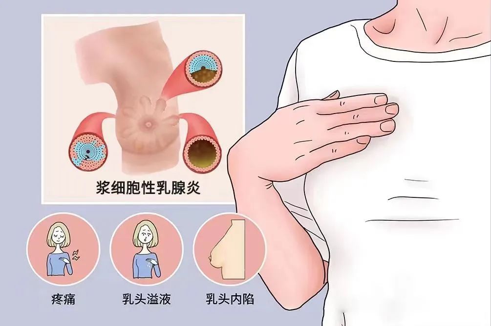 爸爸辅导作业生气郁结，乳房竟长出肿块“又红又肿”！网友：特别疼