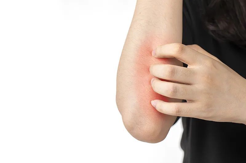 本周日入伏!“冬病夏治”的“三伏贴”适合你吗?贴敷建议来了→ 本周日入伏!“冬病夏治”的“三伏贴”适合你吗?贴敷建议来了→