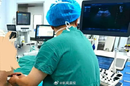 母子平安！347斤产妇生了，医院有史以来接待的最重产妇