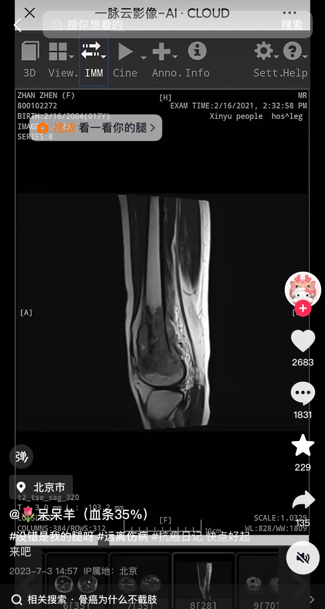 “呆呆羊”不幸离世,年仅22岁 “呆呆羊”不幸离世,年仅22岁