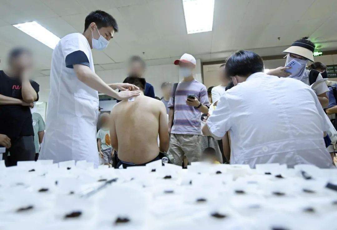 三伏贴调整一下！罕见“短伏年”来了，中医专家提醒