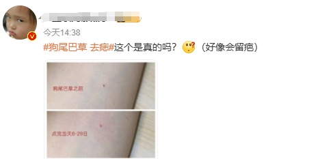 用狗尾巴草点痣？紧急提醒：有癌变风险！