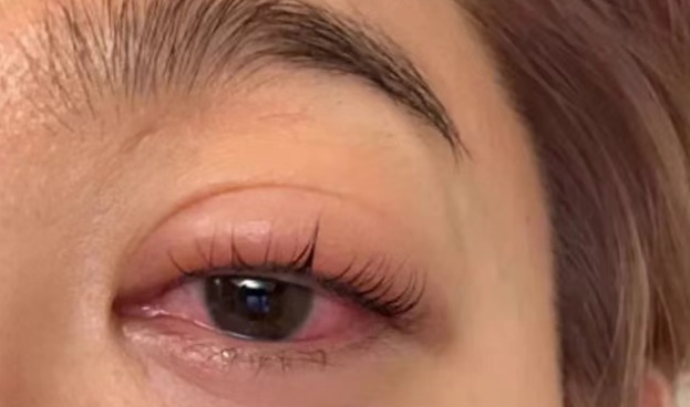 注意，这些东西不能放进微波炉！已有女演员眼睛被炸伤