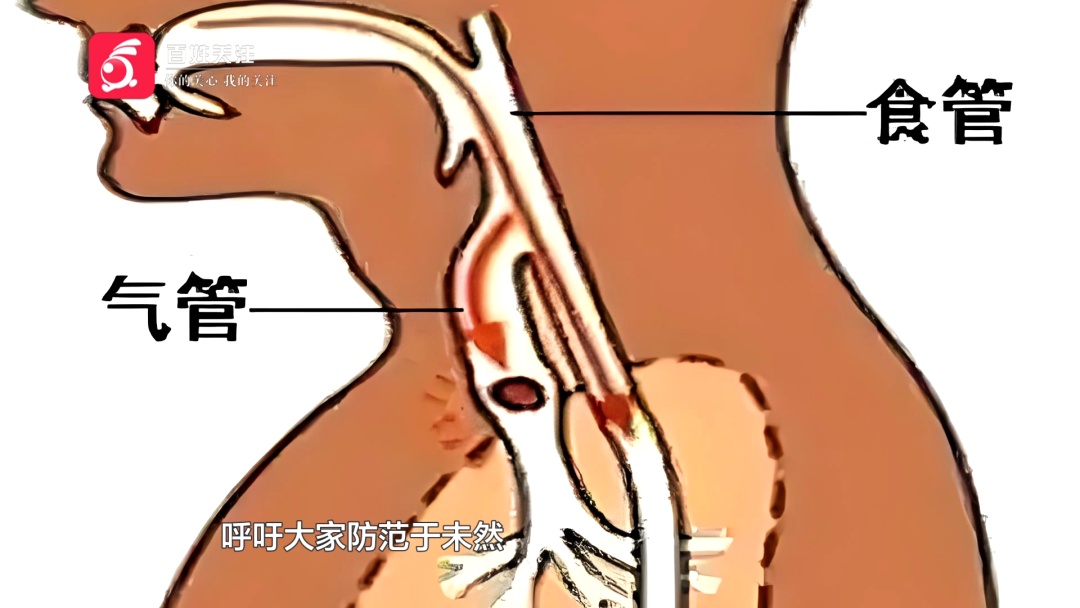 3岁幼童面色涨红濒临窒息，只因吃了这个东西！速转，这些食物别给孩子吃