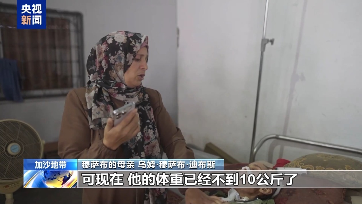 触目惊心 加沙14岁营养不良少年体重仅有10公斤