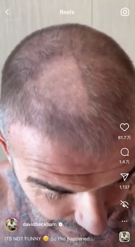 挺“秃然的”!贝克汉姆剃头,翻车了 挺“秃然的”!贝克汉姆剃头,翻车了