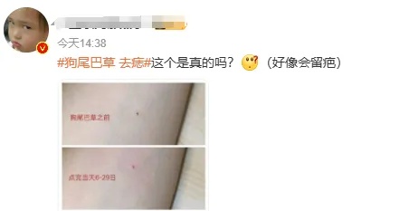 用狗尾巴草点痣？有癌变风险！