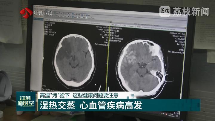 高温“烤”验下 这些健康问题要注意