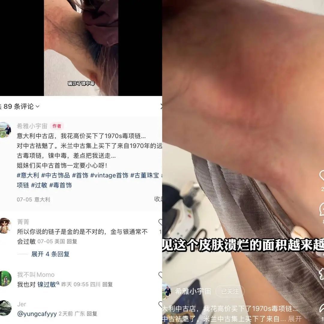 一条来自1970年的“远古项链”,竟让自己中毒了? 一条来自1970年的“远古项链”,竟让自己中毒了?