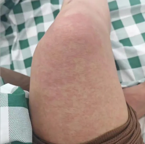 一地确诊超3000例,已现外溢!患者自述发病过程,上海疾控:这些症状及时就医 一地确诊超3000例,已现外溢!患者自述发病过程,上海疾控:这些症状及时就医