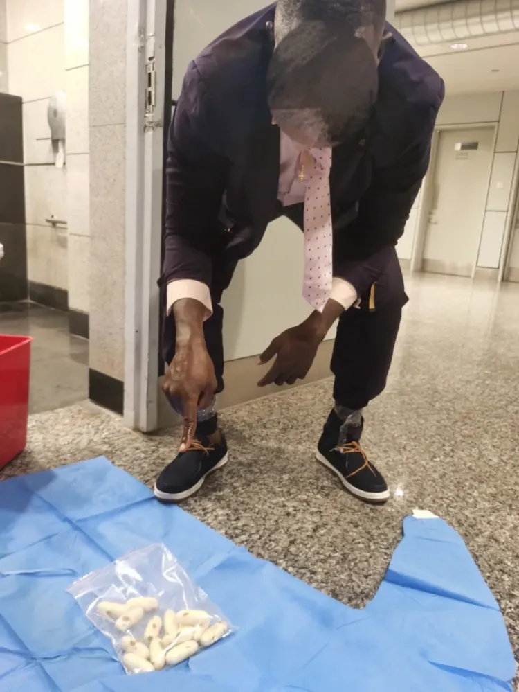 广州白云机场查获人体藏毒大案