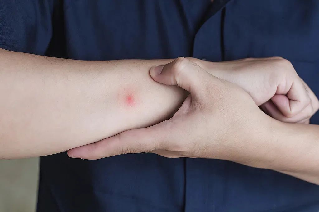 警惕“蚊子刺客”!基孔肯雅热到底是啥? 警惕“蚊子刺客”!基孔肯雅热到底是啥?