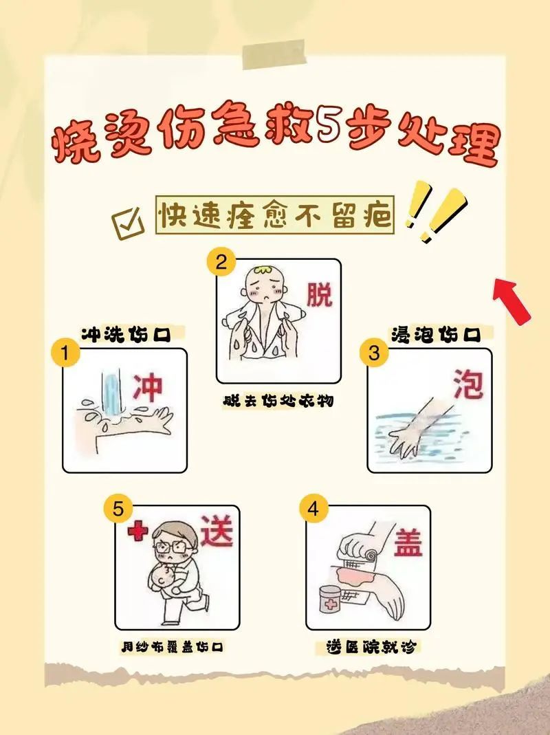 仅10秒就烫伤需植皮！小心这5处烫伤高发地，有些你意想不到