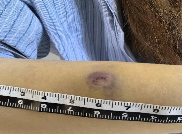 儿时的玩具竟变成犯罪工具！