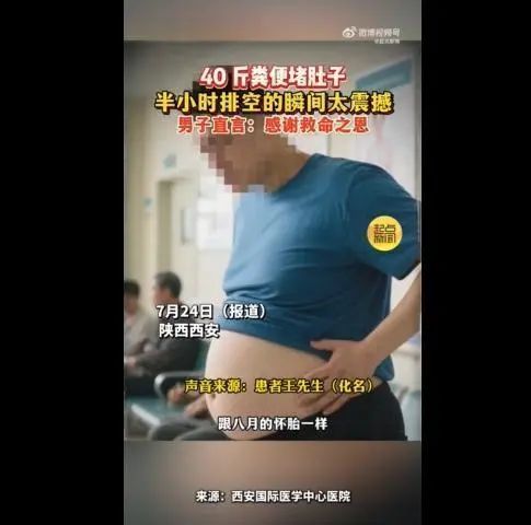 西安一男子体内堆积40斤粪便，肚子如同青蛙鼓胀，手术时如同洪水决堤般喷涌而出
