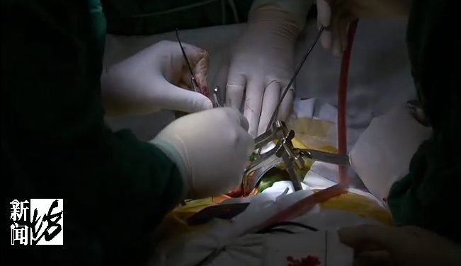 上海百岁阿婆连搓3天麻将,后果严重!多家医院不敢收……医生提醒 上海百岁阿婆连搓3天麻将,后果严重!多家医院不敢收……医生提醒