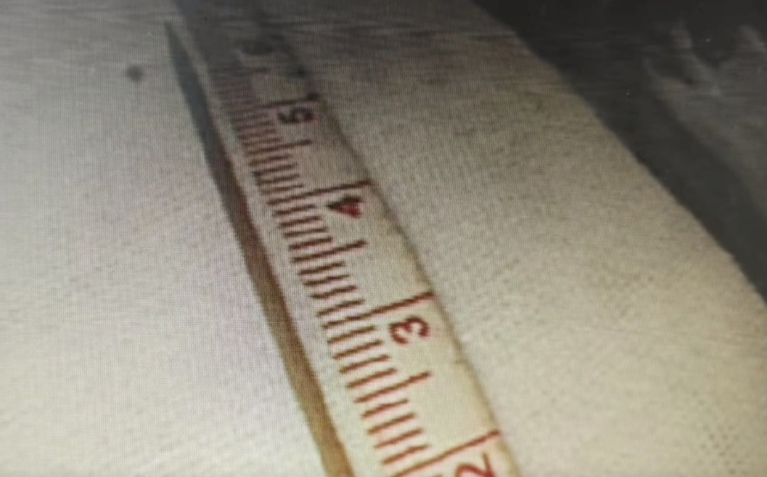 一个动作，男子喝水不慎连它喝进肚，刺穿肠壁直击右肾！