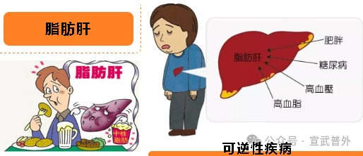 脂肪肝会癌变吗？