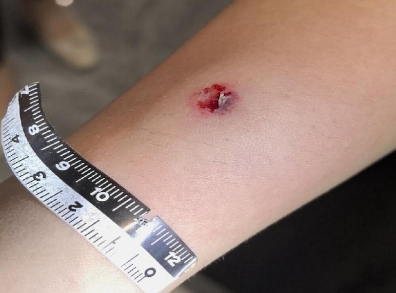 货车司机等红灯无聊竟向路人射钢珠,致4名女性受伤,法院判了→ 货车司机等红灯无聊竟向路人射钢珠,致4名女性受伤,法院判了→