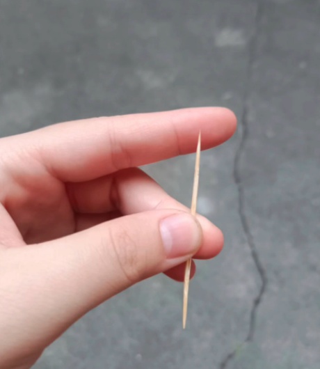 踩到用过的牙签，男子感染多种病菌
