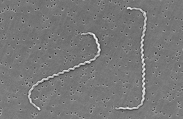致死率高达70%！下雨后，警惕这种传染病…