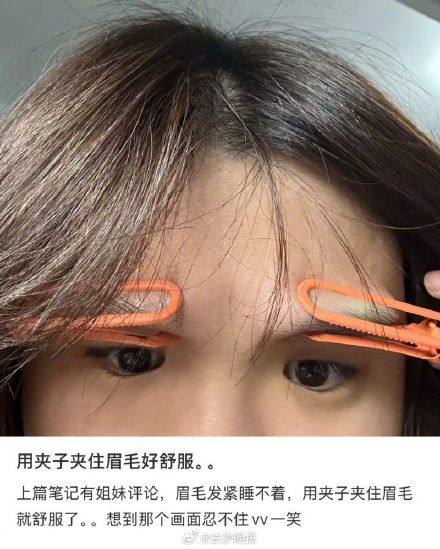 夹子夹眉毛大法真的有用吗