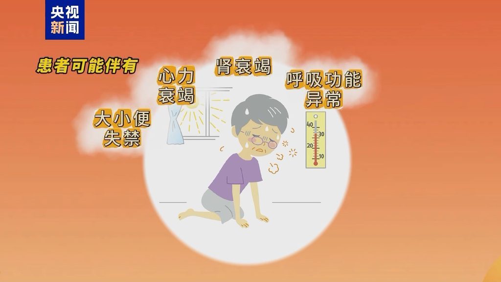 抓住急救黄金30分钟！关于热射病 这些细节要注意