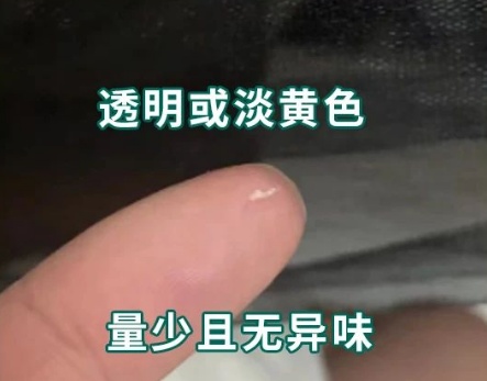 眼睛里拉出长长一根白丝，到底是啥？