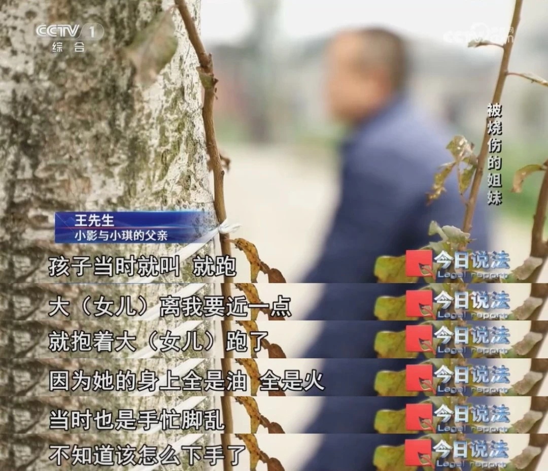 围观砍树遭遇爆燃，年幼姐妹花不幸重度烧伤，陷入巨额医疗费困境……
