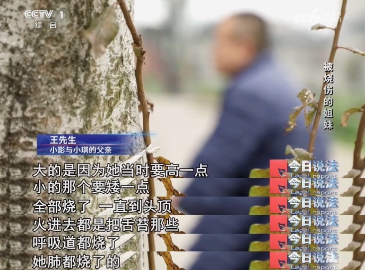 围观砍树遭遇爆燃，年幼姐妹花不幸重度烧伤，陷入巨额医疗费困境……