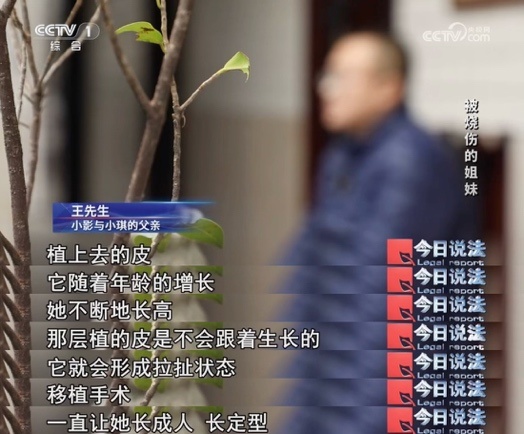 围观砍树遭遇爆燃，年幼姐妹花不幸重度烧伤，陷入巨额医疗费困境……