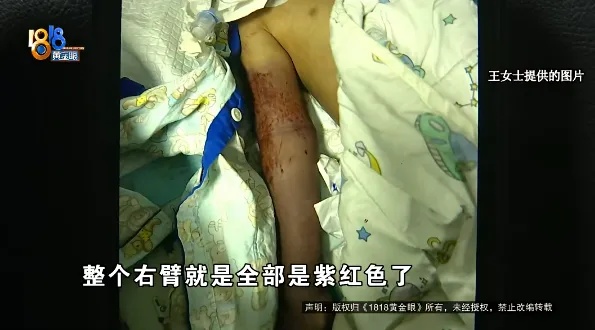 上海6岁男孩意外死亡，在酒店游泳时手臂被这个“黑洞”死死吸住→