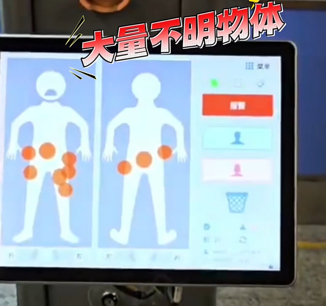 真"腰缠万贯"！小伙上海浦东出关，X光一照，这都啥玩意儿？