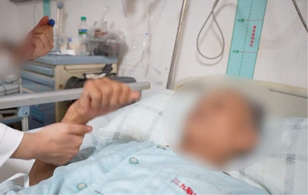 广东阿叔接触生猪肉后突然双耳全聋，医生提醒：戴手套