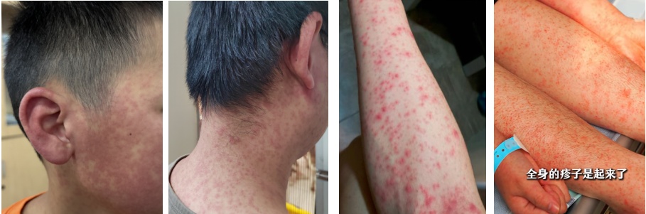 广东开展灭蚊行动! 广东开展灭蚊行动!