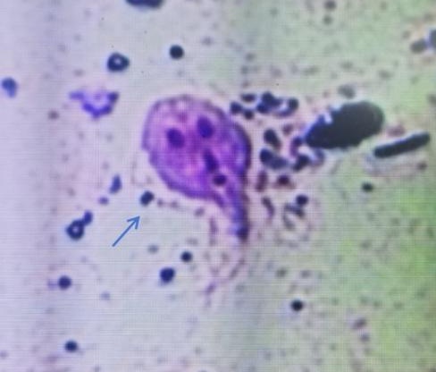 高烧38.9℃！反复不止！福州一男子确诊