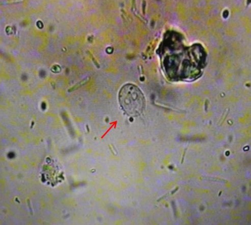 高烧38.9℃！反复不止！福州一男子确诊