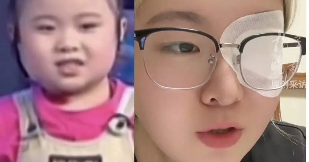 突然自曝！知名童星右眼失明，没法治愈
