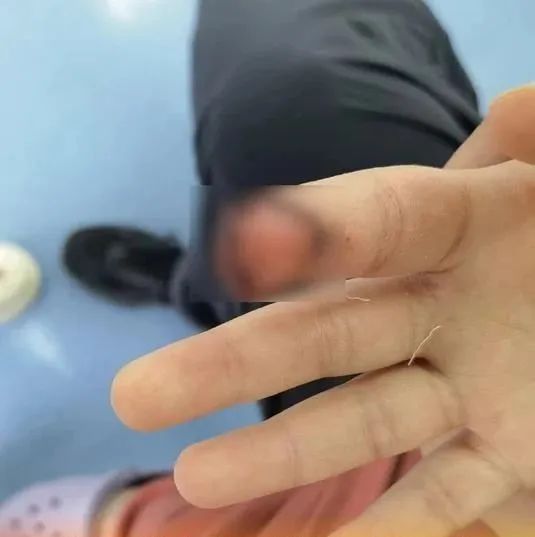 7岁女童被汗血宝马咬伤手指，涉事景区回应