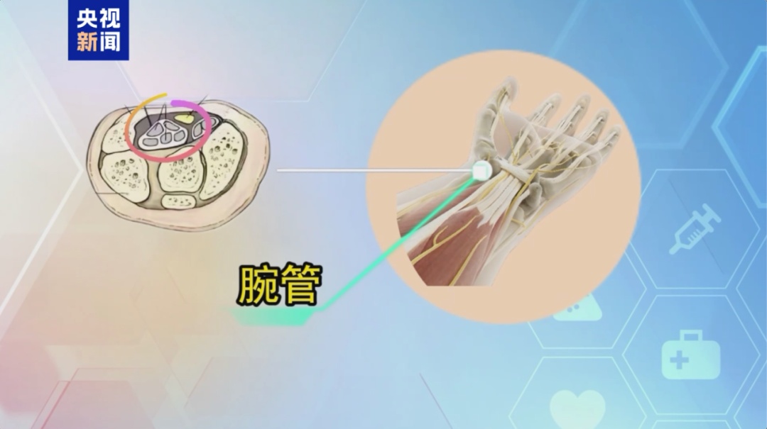 “鼠标手”正式纳入职业病！