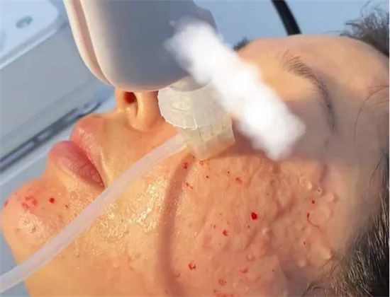 低价水光针、医美“三无”产品……脸能扛住？避坑要紧！