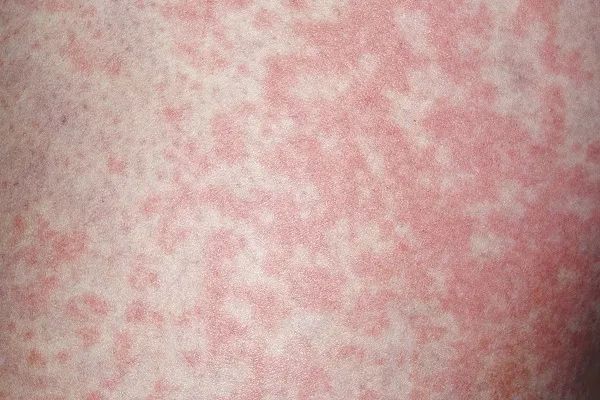 内衣袜子混洗，男子确诊感染！注意！