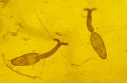 接触10秒即可感染 汛期当心这种病 接触10秒即可感染 汛期当心这种病